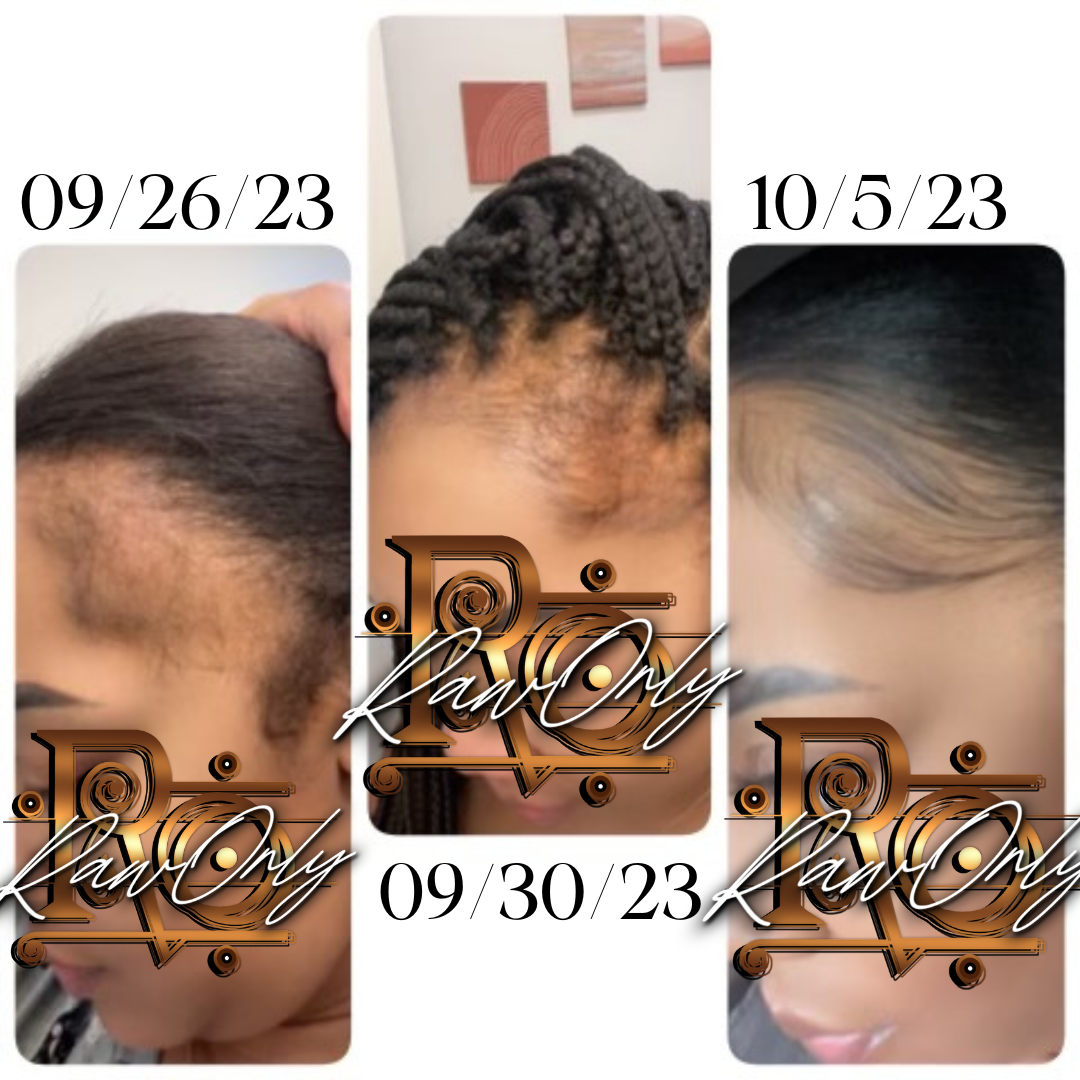 HOLYGRAIL hair growth oil